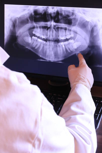 Best Emergency Wisdom Teeth Removal in Powells Crossroads, TN